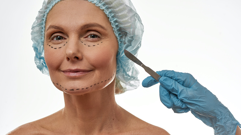 woman's body being marked up before face/neck lift procedure
